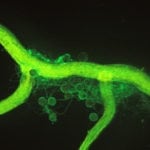 Glomaline : indicateur pour l’azote du sol